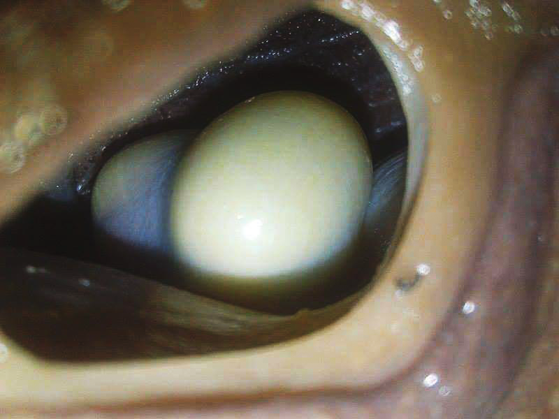Œufs visibles depuis l'oviducte à travers le pneumostome d'un Archachatina marginata ovum (répondant au petit nom de 'Ovy')